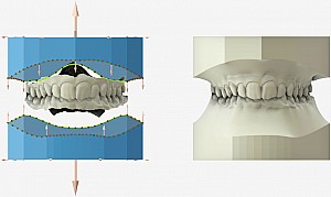 Shining3D - CAD/CAM Maestro 3D Ortho "B" config