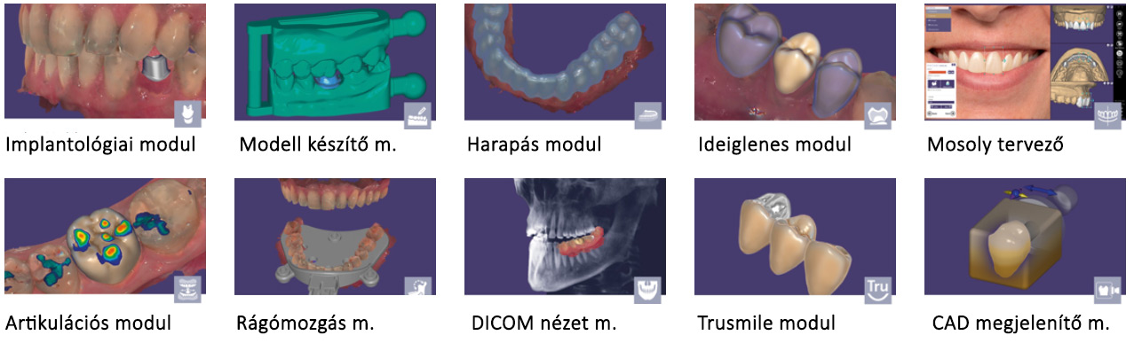 Shining3D - CAD/CAM EXOCAD (kiegészítő modulok)
